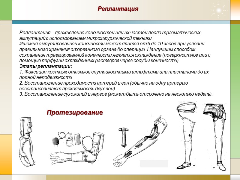 Протезирование Реплантация – приживление конечностей или их частей после травматических ампутаций с использованием микрохирургической